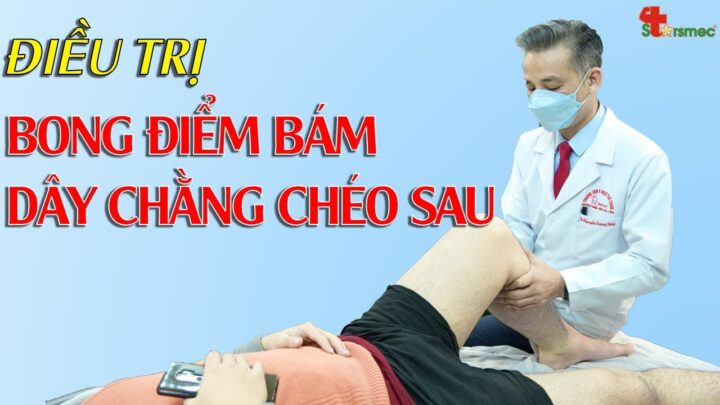 Chéo Kèo Là Sao? Hướng Dẫn Chi Tiết Để Thắng Lớn Với Kèo Chéo