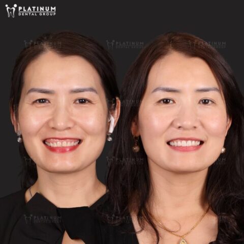 Hiểu Các Kèo Độ Bóng Là Như Thế Nào: Cẩm Nang Toàn Diện Từ A-Z Hiểu Các Kèo Độ Bóng Là Như Thế Nào: Cẩm Nang Toàn Diện Từ A-Z